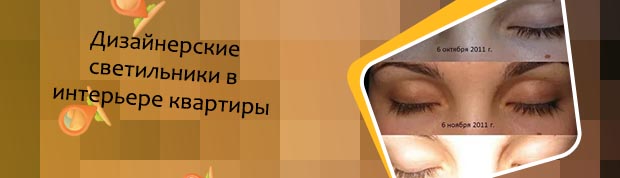 Карепрост до и после